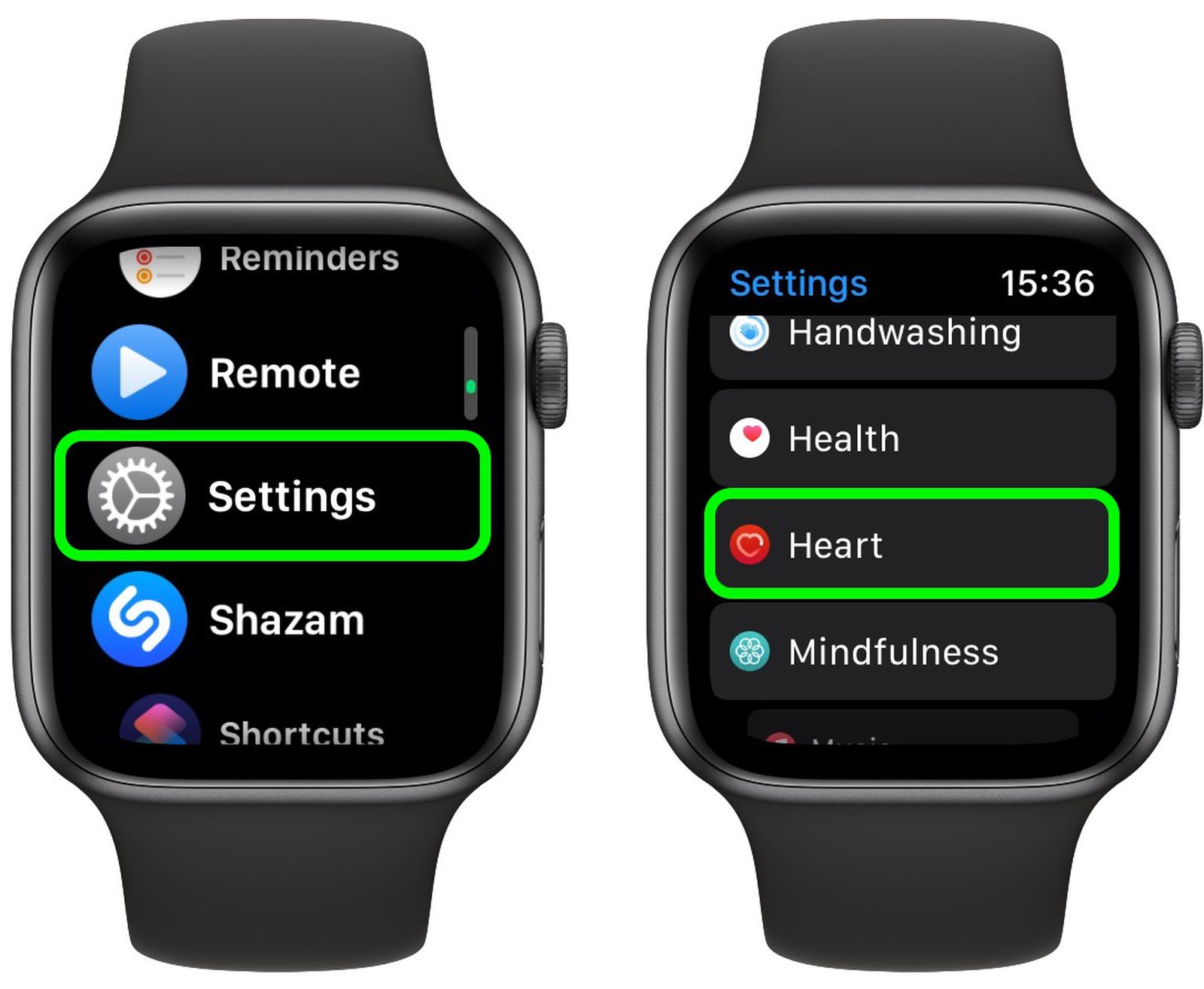 apple watch irregular rhythm1