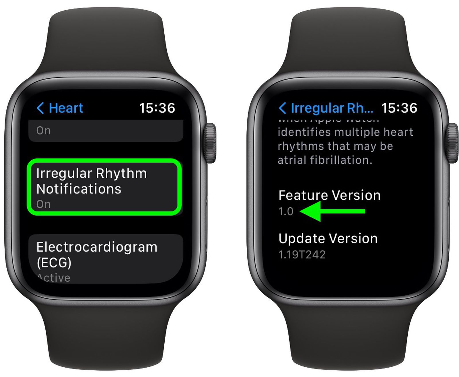 apple watch irregular rhythm2